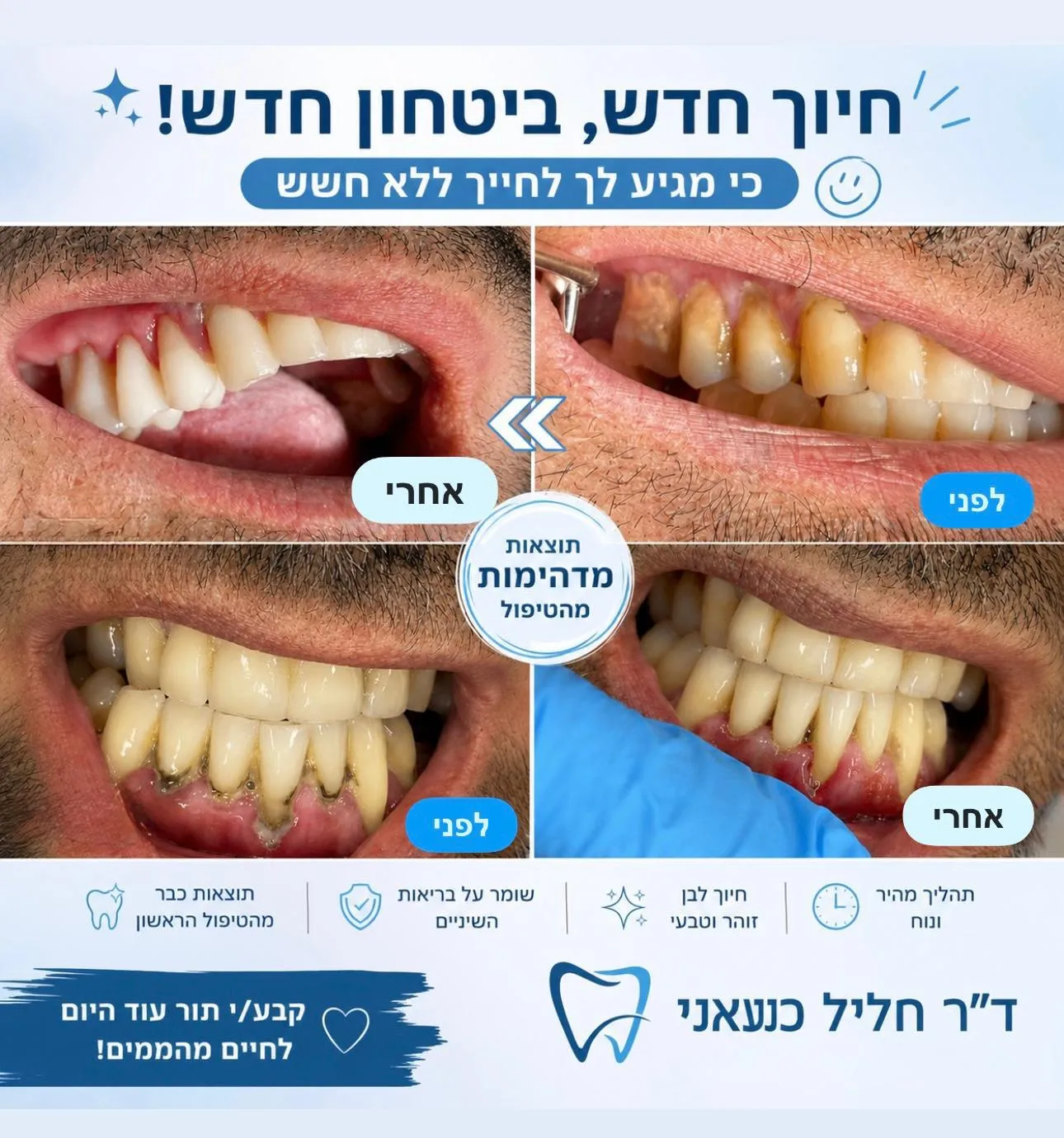פרסום של המרפאה עם ארבע תמונות של שיניים בזוויות שונות, מסומנות לפני ואחרי