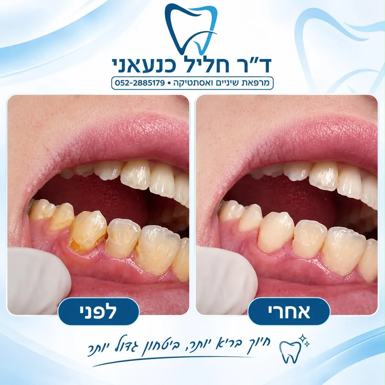 פרסום של המרפאה עם שתי תמונות של השיניים והחניכיים, מסומנות לפני ואחרי